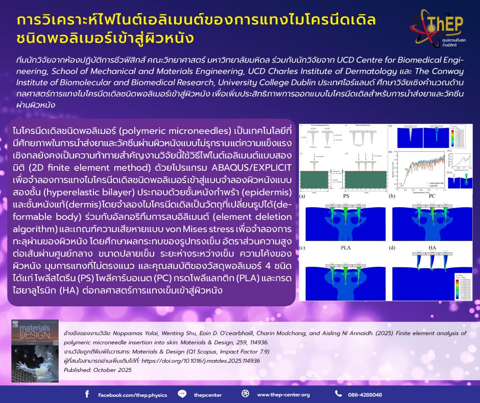 Read more about the article การวิเคราะห์ไฟไนต์เอลิเมนต์ของการแทงไมโครนีดเดิลชนิดพอลิเมอร์เข้าสู่ผิวหนัง